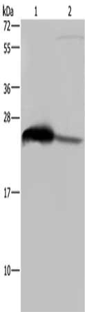 Gel: 10%SDS-PAGE, Lysate: 40 μg, Lane 1-2: Human testis tissue, HepG2 cells, Primary antibody: GSTA3 Antibody(GSTA3 Antibody) at dilution 1/250, Secondary antibody: Goat anti rabbit IgG at 1/8000 dilution, Exposure time: 10 secondsRabbit anti-Human GSTA3 Polyclonal Antibody