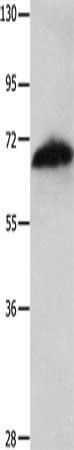 Gel: 10%SDS-PAGE, Lysate: 60 μg, Lane: Jurkat cells, Primary antibody: AIFM1 Antibody(AIFM1 Antibody) at dilution 1/150, Secondary antibody: Goat anti rabbit IgG at 1/8000 dilution, Exposure time: 40 secondsRabbit anti-Human AIFM1 Polyclonal Antibody