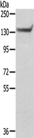 Gel: 6%SDS-PAGE,Lysate: 40 μg,,Primary antibody: SASH1 Antibody(SASH1 Antibody) at dilution 1/200 dilution,Secondary antibody: Goat anti rabbit IgG at 1/8000 dilution,Exposure time: 5 secondsRabbit anti-Human SASH1 Polyclonal Antibody