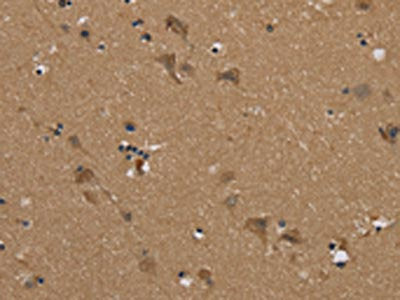 The image on the left is immunohistochemistry of paraffin-embedded Human brain  tissue using PUS10 Antibody(PUS10 Antibody) at dilution 1/45, on the right is treated with synthetic peptide. (Original magnification: ×200)Rabbit anti-Human PUS10 Polyclonal Antibody
