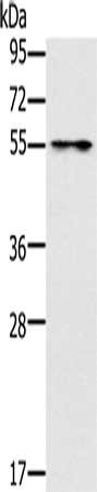 Gel: 8%SDS-PAGE, Lysate: 40 μg, Lane: Mouse intestinum tenue tissue, Primary antibody: PUS10 Antibody(PUS10 Antibody) at dilution 1/200, Secondary antibody: Goat anti rabbit IgG at 1/8000 dilution, Exposure time: 3 secondsRabbit anti-Human PUS10 Polyclonal Antibody