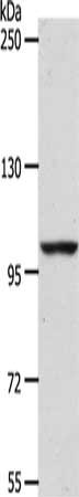 Gel: 8%SDS-PAGE, Lysate: 40 μg, Lane: NIH/3T3 cells, Primary antibody: ADAMTS17 Antibody(ADAMTS17 Antibody) at dilution 1/1200, Secondary antibody: Goat anti rabbit IgG at 1/8000 dilution, Exposure time: 1 hourRabbit anti-Human ADAMTS17 Polyclonal Antibody