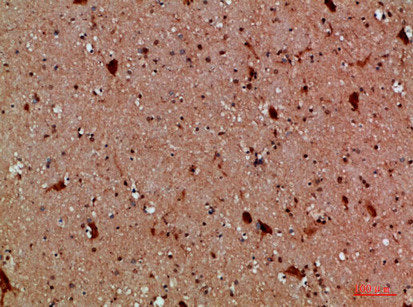 Immunohistochemical analysis of paraffin-embedded human-brain, antibody was diluted at 1:200