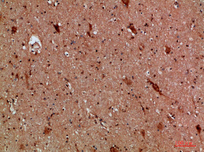 Immunohistochemical analysis of paraffin-embedded human-brain, antibody was diluted at 1:200