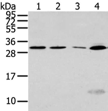 Gel: 12%SDS-PAGE, Lysate: 40 μg, Lane 1-4: Hela, Jurkat and hepg2 cell, human fetal liver tissue, Primary antibody: SIAH1 Antibody(SIAH1 Antibody) at dilution 1/300 dilution, Secondary antibody: Goat anti rabbit IgG at 1/8000 dilution, Exposure time: 1 minuteRabbit anti-Human SIAH1 Polyclonal Antibody