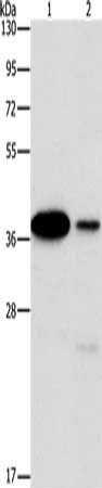 Gel: 15%SDS-PAGE, Lysate: 40 μg, Lane 1-2: 293T cells, A431 cells, Primary antibody: SAE1 Antibody(SAE1 Antibody) at dilution 1/250, Secondary antibody: Goat anti rabbit IgG at 1/8000 dilution, Exposure time: 1 secondRabbit anti-Human SAE1 Polyclonal Antibody
