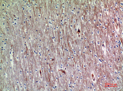 Immunohistochemical analysis of paraffin-embedded human-brain, antibody was diluted at 1:200Rabbit anti-Human ADAMTS18 Polyclonal Antibody