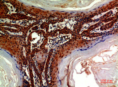 Immunohistochemical analysis of paraffin-embedded human-skin, antibody was diluted at 1:200Rabbit anti-Human ADAMTS18 Polyclonal Antibody
