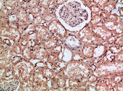 Immunohistochemical analysis of paraffin-embedded human-kidney, antibody was diluted at 1:200Rabbit anti-Human HMMR Polyclonal Antibody