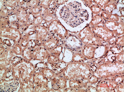 Immunohistochemical analysis of paraffin-embedded human-kidney, antibody was diluted at 1:200Rabbit anti-Human HMMR Polyclonal Antibody