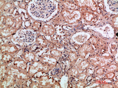 Immunohistochemical analysis of paraffin-embedded human-kidney, antibody was diluted at 1:200Rabbit anti-Human HMMR Polyclonal Antibody