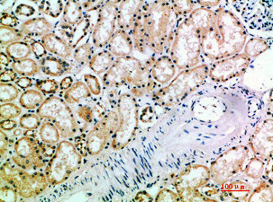 Immunohistochemical analysis of paraffin-embedded human-kidney, antibody was diluted at 1:200