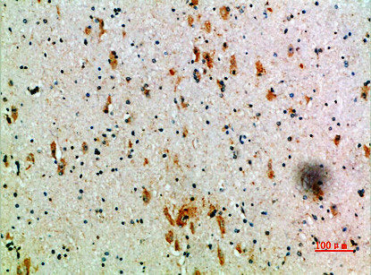 Immunohistochemical analysis of paraffin-embedded human-brain, antibody was diluted at 1:200