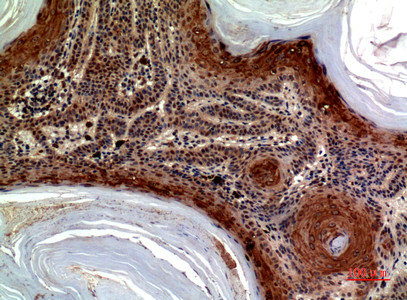 Immunohistochemical analysis of paraffin-embedded human-skin, antibody was diluted at 1:100Rabbit anti-Human CCL27 Polyclonal Antibody