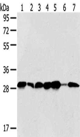 Gel: 8%SDS-PAGE,Lysate: 40 μg,Lane 1-7: Jurkat cells, Hela cells, 293T cells, 231 cells, HepG2 cells, Human normal liver tissue, Human bladder carcinoma tissue,Primary antibody: SRPRB Antibody(SRPRB Antibody) at dilution 1/500 dilution,Secondary antibody: Goat anti rabbit IgG at 1/8000 dilution,Exposure time: 5 secondsRabbit anti-Human SRPRB Polyclonal Antibody