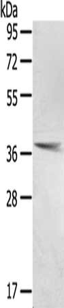 Gel: 8%SDS-PAGE, Lysate: 40 μg, Lane: Human normal lung tissue, Primary antibody: PTX3 Antibody(PTX3 Antibody) at dilution 1/400, Secondary antibody: Goat anti rabbit IgG at 1/8000 dilution, Exposure time: 20 secondsRabbit anti-Human PTX3 Polyclonal Antibody