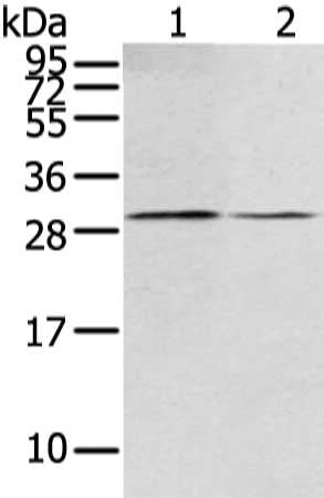 Gel: 12%SDS-PAGE, Lysate: 40 μg, Lane 1-2: Mouse kidney tissue and hela cell, Primary antibody: RASD2 Antibody(RASD2 Antibody) at dilution 1/400 dilution, Secondary antibody: Goat anti rabbit IgG at 1/8000 dilution, Exposure time: 10 secondsRabbit anti-Human RASD2 Polyclonal Antibody