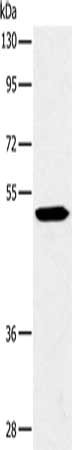 Gel: 8%SDS-PAGE, Lysate: 40 μg, Lane: A549 cells, Primary antibody: MAPKAPK2 Antibody(MAPKAPK2 Antibody) at dilution 1/300, Secondary antibody: Goat anti rabbit IgG at 1/8000 dilution, Exposure time: 3 minutes