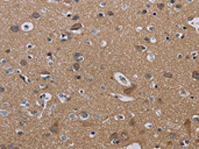 The image on the left is immunohistochemistry of paraffin-embedded Human brain  tissue using PVRL3 Antibody(PVRL3 Antibody) at dilution 1/40, on the right is treated with fusion protein. (Original magnification: ×200)Rabbit anti-Human PVRL3 Polyclonal Antibody