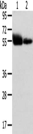 Gel: 8%SDS-PAGE, Lysate: 40 μg, Lane 1-2: Human placenta tissue and normal liver tissue, Primary antibody: SLC1A1 Antibody(SLC1A1 Antibody) at dilution 1/400 dilution, Secondary antibody: Goat anti rabbit IgG at 1/8000 dilution, Exposure time: 4 minutesRabbit anti-Human SLC1A1 Polyclonal Antibody