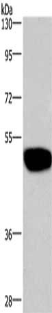 Gel: 8%SDS-PAGE, Lysate: 40 μg, Lane: LoVo cells, Primary antibody: GABRA1 Antibody(GABRA1 Antibody) at dilution 1/300, Secondary antibody: Goat anti rabbit IgG at 1/8000 dilution, Exposure time: 1 minuteRabbit anti-Human GABRA1 Polyclonal Antibody