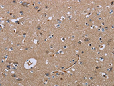 The image on the left is immunohistochemistry of paraffin-embedded Human brain  tissue using LCMT1 Antibody(LCMT1 Antibody) at dilution 1/20, on the right is treated with fusion protein. (Original magnification: ×200)