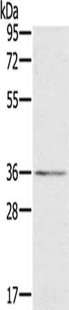 Gel: 8%SDS-PAGE, Lysate: 40 μg, Lane: 231 cells, Primary antibody: LCMT1 Antibody(LCMT1 Antibody) at dilution 1/400, Secondary antibody: Goat anti rabbit IgG at 1/8000 dilution, Exposure time: 1 minute