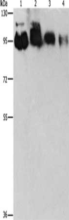 Gel: 8%SDS-PAGE, Lysate: 40 μg, Lane 1-4: Hela cells, PC3 cells, 231 cells, 293T cells, Primary antibody: EPS15L1 Antibody(EPS15L1 Antibody) at dilution 1/350, Secondary antibody: Goat anti rabbit IgG at 1/8000 dilution, Exposure time: 30 secondsRabbit anti-Human EPS15L1 Polyclonal Antibody