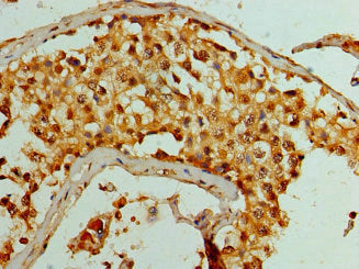 Immunohistochemistry of paraffin-embedded human testis tissue using KDM1A Antibody at dilution of 1:100