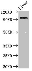 Western Blot  | Positive WB detected in: Mouse liver tissue  | All lanes: KDM1A antibody at 2μg/ml  | Secondary  | Goat polyclonal to rabbit IgG at 1/50000 dilution  | Predicted band size: 93, 96 kDa  | Observed band size: 93 kDa