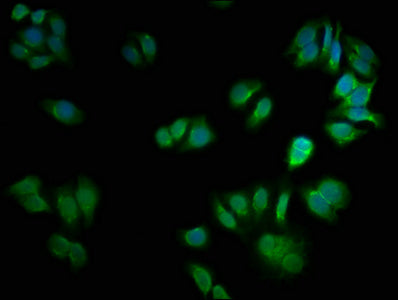 Immunofluorescence staining of HepG2 cells with CSNK2A2 Antibody at 1:66, counter-stained with DAPI. The cells were fixed in 4% formaldehyde, permeabilized using 0.2% Triton X-100 and blocked in 10% normal Goat Serum. The cells were then incubated with the antibody overnight at 4°C. The secondary antibody was Alexa Fluor 488-congugated AffiniPure Goat Anti-Rabbit IgG(H+L).