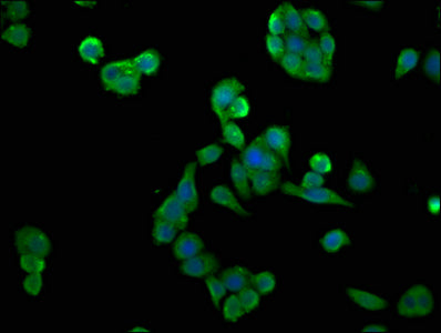 Immunofluorescence staining of PC-3 cells with CSNK2A2 Antibody at 1:133, counter-stained with DAPI. The cells were fixed in 4% formaldehyde, permeabilized using 0.2% Triton X-100 and blocked in 10% normal Goat Serum. The cells were then incubated with the antibody overnight at 4°C. The secondary antibody was Alexa Fluor 488-congugated AffiniPure Goat Anti-Rabbit IgG(H+L).