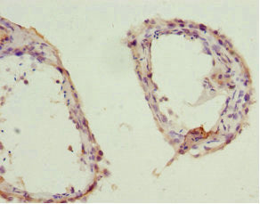 Immunohistochemistry of paraffin-embedded human testis tissue using ZWINT Antibody at dilution of 1:100Rabbit anti-Human ZWINT Polyclonal Antibody