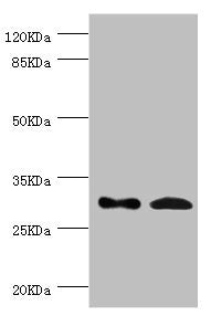 Western blot | All lanes: ZWINT antibody at 8.93μg/ml | Lane 1: Hela whole cell lysate | Lane 2: Mouse liver tissue | Secondary | Goat polyclonal to rabbit IgG at 1/10000 dilution | Predicted band size: 32, 26 kDa | Observed band size: 32 kDaRabbit anti-Human ZWINT Polyclonal Antibody