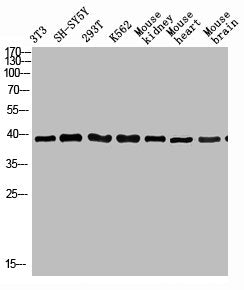 Western Blot analysis of various cells using Antibody diluted at 1:1000. Secondary antibody  was diluted at 1:20000