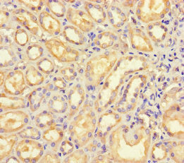 Immunohistochemistry of paraffin-embedded human kidney tissue using B4GALT5 Antibody at dilution of 1:100