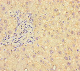 Immunohistochemistry of paraffin-embedded human liver tissue using B4GALT5 Antibody at dilution of 1:100
