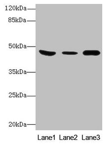 Western Blot  | All lanes: B4GALT5 antibody at 8µg/ml  | Lane 1: Mouse heart tissue  | Lane 2: Mouse liver tissue  | Lane 3: Mouse brain tissue  | Secondary  | Goat polyclonal to rabbit IgG at 1/10000 dilution  | Predicted band size: 46 kDa  | Observed band size: 46 kDa