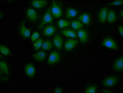 Immunofluorescence staining of A549 cells with PDE9A Antibody at 1:200, counter-stained with DAPI. The cells were fixed in 4% formaldehyde, permeabilized using 0.2% Triton X-100 and blocked in 10% normal Goat Serum. The cells were then incubated with the antibody overnight at 4°C. The secondary antibody was Alexa Fluor 488-congugated AffiniPure Goat Anti-Rabbit IgG(H+L).Rabbit anti-Human PDE9A Polyclonal Antibody