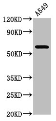 Western Blot  | Positive WB detected in: A549 whole cell lysate  | All lanes: PDE9A antibody at 3.9µg/ml  | Secondary  | Goat polyclonal to rabbit IgG at 1/50000 dilution  | Predicted band size: 69, 62, 55, 63, 58, 46, 59, 51, 45, 54, 65, 66, 57 kDa  | Observed band size: 69 kDaRabbit anti-Human PDE9A Polyclonal Antibody