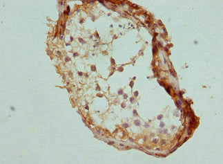 Immunohistochemistry of paraffin-embedded human testis tissue using CCP110 Antibody at dilution of 1:100Rabbit anti-Human CCP110 Polyclonal Antibody