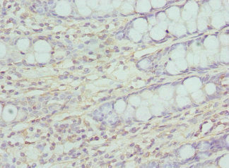 Immunohistochemistry of paraffin-embedded human colon tissue using CCP110 Antibody at dilution of 1:100Rabbit anti-Human CCP110 Polyclonal Antibody