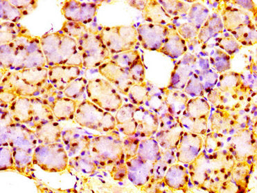 IHC image of URI1 Antibody diluted at 1:300 and staining in paraffin-embedded human salivary gland tissue performed on a Leica BondTM system. After dewaxing and hydration, antigen retrieval was mediated by high pressure in a citrate buffer (pH 6.0). Section was blocked with 10% normal goat serum 30min at RT. Then primary antibody (1% BSA) was incubated at 4°C overnight. The primary is detected by a biotinylated secondary antibody and visualized using an HRP conjugated SP system.Rabbit anti-Human URI1 Polyclonal Antibody