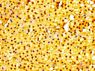 IHC image of URI1 Antibody diluted at 1:300 and staining in paraffin-embedded human adrenal gland tissue performed on a Leica BondTM system. After dewaxing and hydration, antigen retrieval was mediated by high pressure in a citrate buffer (pH 6.0). Section was blocked with 10% normal goat serum 30min at RT. Then primary antibody (1% BSA) was incubated at 4°C overnight. The primary is detected by a biotinylated secondary antibody and visualized using an HRP conjugated SP system.Rabbit anti-Human URI1 Polyclonal Antibody