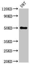 Western Blot  | Positive WB detected in: U87 whole cell lysate  | All lanes: URI1 antibody at 5.3µg/ml  | Secondary  | Goat polyclonal to rabbit IgG at 1/50000 dilution  | Predicted band size: 60, 52, 57, 54 kDa  | Observed band size: 52 kDaRabbit anti-Human URI1 Polyclonal Antibody