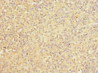 Immunohistochemistry of paraffin-embedded human spleen tissue using COPB2 Antibody at dilution of 1:100Rabbit anti-Human COPB2 Polyclonal Antibody