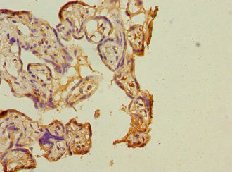 Immunohistochemistry of paraffin-embedded human placenta tissue using COPB2 Antibody at dilution of 1:100Rabbit anti-Human COPB2 Polyclonal Antibody
