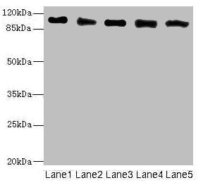 Western blot | All lanes: COPB2 antibody at 2.51μg/ml | Lane 1: Human placenta tissue | Lane 2: MCF-7 whole cell lysate | Lane 3: Hela whole cell lysate | Lane 4: HepG2 whole cell lysate | Lane 5: Jurkat whole cell lysate | Secondary | Goat polyclonal to rabbit IgG at 1/10000 dilution | Predicted band size: 103, 100 kDa | Observed band size: 103 kDaRabbit anti-Human COPB2 Polyclonal Antibody