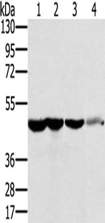 Gel: 8%SDS-PAGE, Lysate: 40 μg, Lane 1-5: HT29 cells, human normal kidney tissue, Lo2 cells, human normal liver tissue, human fetal brain tissue, Primary antibody: RNH1 Antibody(RNH1 Antibody) at dilution 1/400, Secondary antibody: Goat anti rabbit IgG at 1/8000 dilution, Exposure time: 10 secondsRabbit anti-Human RNH1 Polyclonal Antibody