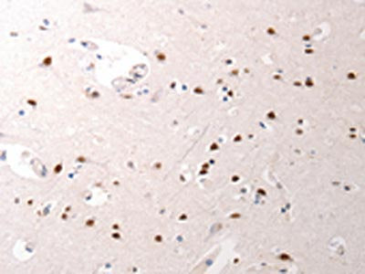 The image on the left is immunohistochemistry of paraffin-embedded Human brain tissue using the antibody Antibody) at dilution 1/40, on the right is treated with synthetic peptide. (Original magnification: ×200)